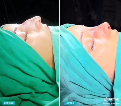 Slider image (4) CorpusRenew by Termessos Hospital